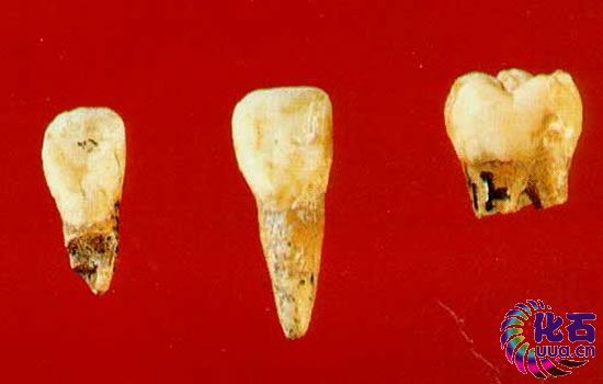铲形门齿是黄种人和中国其他人类化石都具有的