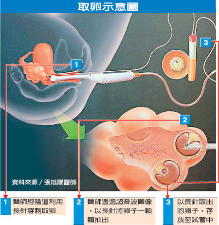 一部分是对自身卵子进行储存的女性
