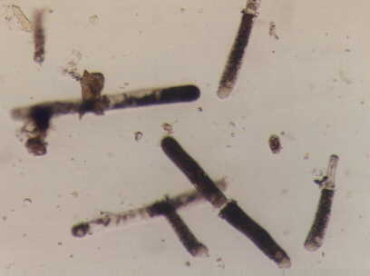 羊肝蛭虫怎么治疗||羊肝怎么做